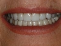 Konig Center for Cosmetic & Comprehensive Dentistry smile photos